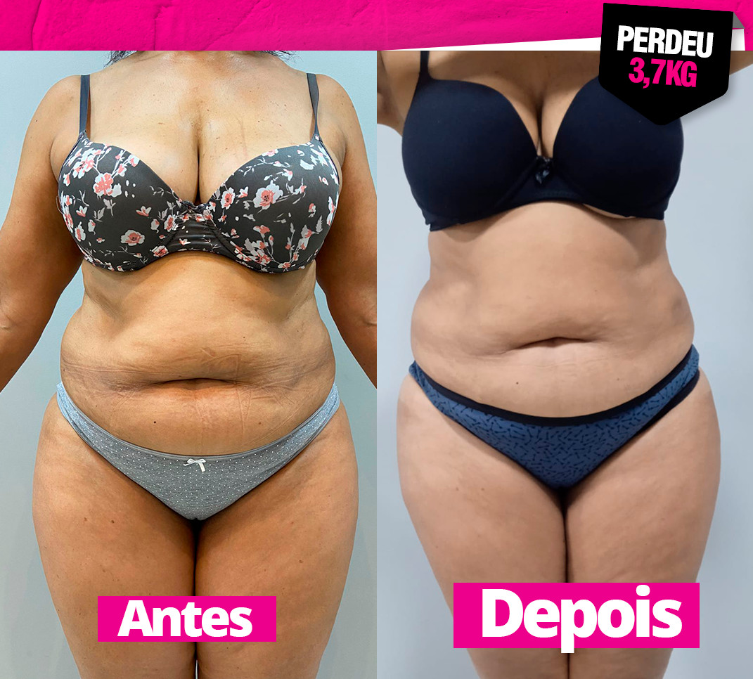 Emagrecimento (1)